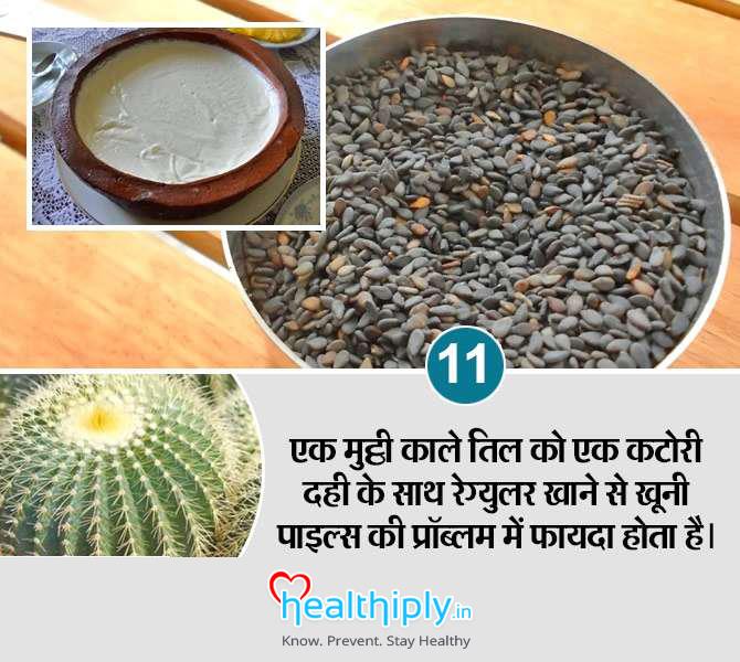 piles-home-remedies-11_14