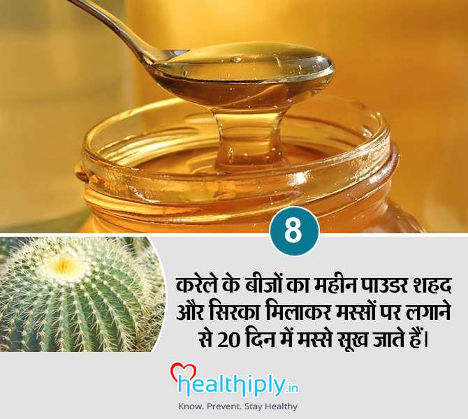 piles-home-remedies-8_149